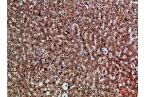 Immunohistochemical analysis of paraffin-embedded human-liver, antibody was diluted at 1:200 (CDNF 抗体  (AA 31-80))