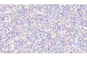 Detection of CNN2 in Human Lymph node Tissue using Polyclonal Antibody to Calponin 2 (CNN2) (CNN2 抗体  (AA 1-269))