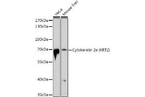 Western blot analysis of extracts of various cell lines, using Cytokeratin 2e (KRT2) antibody (ABIN6129540, ABIN6143025, ABIN6143026 and ABIN6214608) at 1:1000 dilution. (Keratin 2 抗体  (AA 1-220))