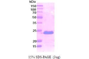 Podoplanin Protein (PDPN) (AA 99-207) (His tag)