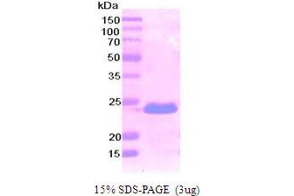 Podoplanin Protein (PDPN) (AA 99-207) (His tag)