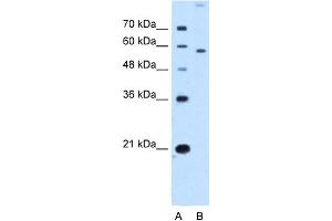 WB Suggested Anti-SLC22A2 Antibody Titration:  2. (SLC22A2 抗体  (N-Term))