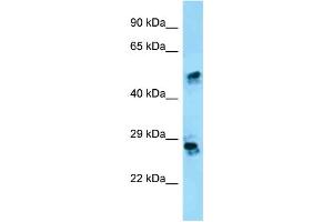 WB Suggested Anti-CRISP1 Antibody Titration: 1. (CRISP1 抗体  (N-Term))