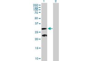 Western Blot analysis of C9orf152 expression in transfected 293T cell line by C9orf152 MaxPab polyclonal antibody. (C9orf152 抗体  (AA 1-218))