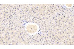 Detection of GLS2 in Mouse Liver Tissue using Polyclonal Antibody to Glutaminase 2 (GLS2) (GLS2 抗体  (AA 154-479))
