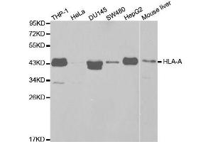 Western blot analysis of extracts of various cell lines, using HLA-A antibody. (HLA-A 抗体  (AA 35-285))
