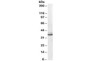 Western blot testing of human liver lysate with AKR1C4 antibody at 0. (AKR1C4 抗体)