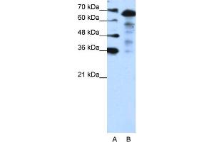 WB Suggested Anti-MLXIPL Antibody Titration:  1. (MLXIPL 抗体  (N-Term))