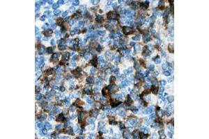 Immunohistochemical analysis of CDKL3 staining in human lymph node formalin fixed paraffin embedded tissue section. (CDKL3 抗体  (Center))