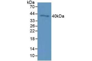 Detection of CD72 in Mouse Testis Tissue using Polyclonal Antibody to Cluster Of Differentiation 72 (CD72) (CD72 抗体  (AA 169-359))