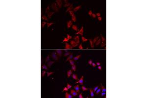 Immunofluorescence analysis of MCF7 cells using PCBD1 antibody.