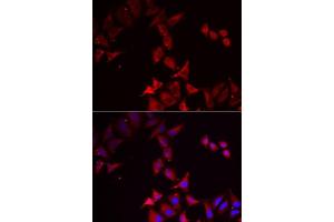 Immunofluorescence analysis of MCF7 cells using PCBD1 antibody. (PCBD1 抗体  (AA 1-104))