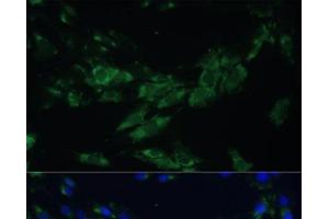 Immunofluorescence analysis of C6 cells using EPHA4 Polyclonal Antibody at dilution of 1:100. (EPH Receptor A4 抗体)
