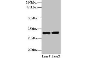 Western blot All lanes: UQCRQ antibody at 2 μg/mL Lane 1: EC109 whole cell lysate Lane 2: 293T whole cell lysate Secondary Goat polyclonal to rabbit IgG at 1/15000 dilution Predicted band size: 10 kDa Observed band size: 30 kDa (UQCRQ 抗体  (AA 2-78))