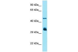 Western Blotting (WB) image for anti-Interferon-Induced Protein with Tetratricopeptide Repeats 1 (IFIT1) (Middle Region) antibody (ABIN2490346) (IFIT1 抗体  (Middle Region))