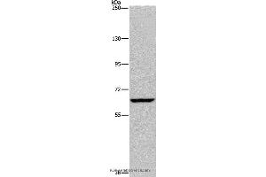 Western blot analysis of Hela cell, using IVL Polyclonal Antibody at dilution of 1:200 (Involucrin 抗体)