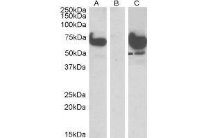 HEK293 lysate (10ug protein in RIPA buffer) overexpressing Human EPM2AIP1 with DYKDDDDK tag probed with ABIN2562449 (1ug/ml) in Lane A and probed with anti-DYKDDDDK Tag (1/1000) in lane C. (EPM2A (Laforin) IP1 (N-Term) 抗体)