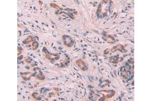 Used in DAB staining on fromalin fixed paraffin- embedded Kidney tissue (MYL6 抗体  (AA 4-146))