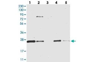 Western blot analysis of Lane 1: RT-4, Lane 2: U-251 MG, Lane 3: Human Plasma, Lane 4: Liver, Lane 5: Tonsil with CCDC90B polyclonal antibody  at 1:250-1:500 dilution. (CCDC90B 抗体)