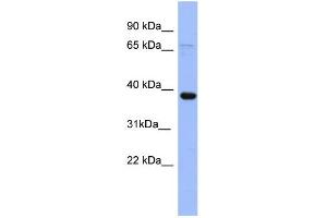 WB Suggested Anti-IER5 Antibody Titration: 0. (IER5 抗体  (N-Term))
