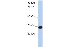 RAB39B antibody used at 1 ug/ml to detect target protein. (RAB39B 抗体  (N-Term))