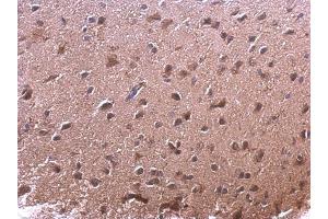 IHC-P Image AKR7A2 antibody detects AKR7A2 protein at cytoplasm on mouse fore brain by immunohistochemical analysis. (AKR7A2 抗体)