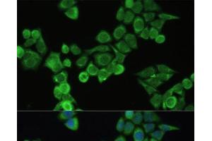 Immunofluorescence analysis of HeLa cells using Fibronectin Polyclonal Antibody at dilution of 1:100. (Fibronectin 抗体)