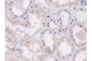 Detection of ADAMTS10 in Human Kidney Tissue using Polyclonal Antibody to A Disintegrin And Metalloproteinase With Thrombospondin 10 (ADAMTS10)