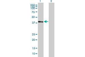 Western Blotting (WB) image for anti-POU Domain, Class 3, Transcription Factor 4 (POU3F4) (AA 1-361) antibody (ABIN5585985)