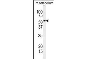 Western Blotting (WB) image for anti-Receptor-Interacting serine-threonine Kinase 3 (RIPK3) (AA 61-91) antibody (ABIN391273)