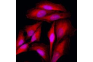 Immunofluorescence of HeLa cells stained with Hoechst 3342 (Blue) for nucleus staining and monoclonal anti-human KRT18 antibody (1:500) with Texas Red (Red). (Cytokeratin 18 抗体  (AA 79-430))
