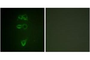 Immunofluorescence analysis of HepG2 cells, using TIE2 (Phospho-Tyr1108) Antibody. (TEK 抗体  (pTyr1108))
