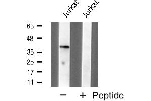 Western blot analysis of MKP1 expression in Jurkat cell extracts (DUSP1 抗体  (C-Term))