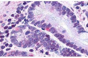 Image no. 1 for anti-Glucagon-Like Peptide 2 Receptor (GLP2R) (N-Term) antibody (ABIN1048667) (GLP2R 抗体  (N-Term))