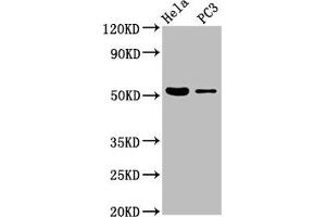 Western Blot Positive WB detected in: Hela whole cell lysate, PC-3 whole cell lysate All lanes: CELF6 antibody at 3. (CELF6 抗体  (AA 292-395))