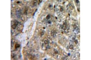 Used in DAB staining on fromalin fixed paraffin-embedded Liver tissue (SP100 抗体  (AA 261-465))