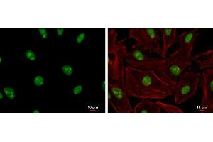 ICC/IF Image ADAR1 antibody [N3C1], Internal detects ADAR1 protein at nucleolus and nucleus by immunofluorescent analysis. (ADAR 抗体)