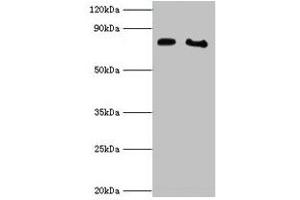 Western blot All lanes: POR antibody at 2 μg/mL Lane 1: K562 whole cell lysate Lane 2: A431 whole cell lysate Secondary Goat polyclonal to rabbit IgG at 1/10000 dilution Predicted band size: 77 kDa Observed band size: 77 kDa (POR 抗体  (AA 2-671))