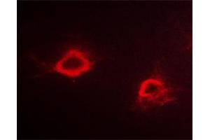 ABIN6267298 staining Hela cells by ICC/IF. (APP 抗体  (pThr668))