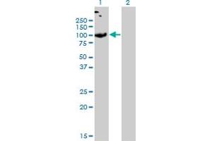Western Blot analysis of SLC26A2 expression in transfected 293T cell line by SLC26A2 monoclonal antibody (M04), clone 3F6. (SLC26A2 抗体  (AA 1-108))