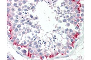 Anti-SLC30A9 / ZNT9 antibody IHC staining of human testis. (SLC30A9 抗体  (AA 103-151))