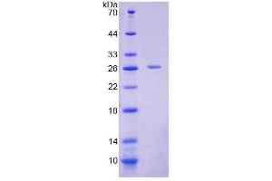 SDS-PAGE analysis of Rat CACT Protein. (SLC25A20 蛋白)