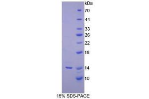 SDS-PAGE analysis of Human Inhibin beta C Protein. (INHBC 蛋白)