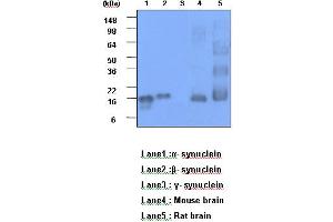 Western Blotting (WB) image for anti-Synuclein, alpha (SNCA) (AA 119-140) antibody (ABIN317563) (SNCA 抗体  (AA 119-140))