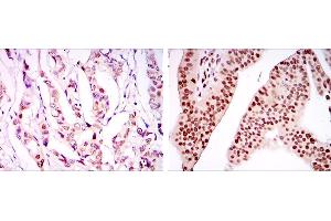Immunohistochemistry (IHC) image for anti-PC4 and SFRS1 Interacting Protein 1 (PSIP1) antibody (ABIN969370)