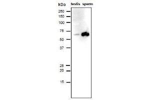 Western Blotting (WB) image for anti-Izumo Sperm-Egg Fusion 1 (IZUMO1) antibody (ABIN2452040) (IZUMO1 抗体)