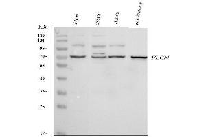 Western blot analysis of FLCN using anti-FLCN antibody (ABIN7602491). (FLCN 抗体  (AA 8-551))