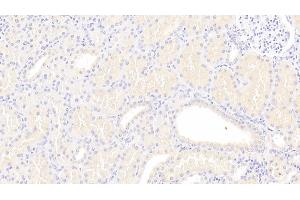 Detection of Lpa in Human Kidney Tissue using Polyclonal Antibody to Lipoprotein, a (Lpa) (Lp(a) 抗体  (AA 1719-2038))
