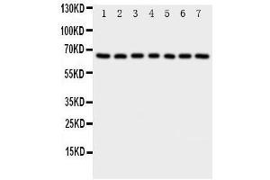 Western Blotting (WB) image for anti-NADPH Oxidase 4 (NOX4) (AA 561-578), (C-Term) antibody (ABIN3044011) (NADPH Oxidase 4 抗体  (C-Term))