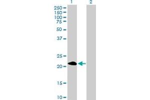 Western Blot analysis of PAGE4 expression in transfected 293T cell line by PAGE4 MaxPab polyclonal antibody. (PAGE4 抗体  (AA 1-102))